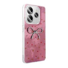 Xiaomi Redmi Note 14 Kılıf Kamera Korumalı Figürlü Ponti Silikon Kapak