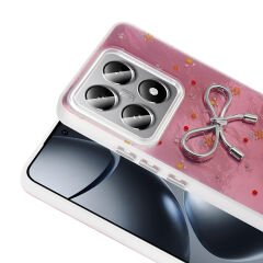 Xiaomi 14T Pro Kılıf Kamera Korumalı Figürlü Ponti Silikon Kapak