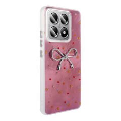 Xiaomi 14T Kılıf Kamera Korumalı Figürlü Ponti Silikon Kapak