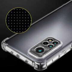 Xiaomi Redmi Note 11 Pro 5G Kılıf Nitro Anti Shock Darbe Emici Köşe Korumalı Şeffaf Silikon Kapak