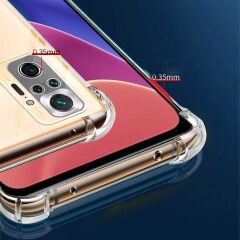 Xiaomi Redmi Note 10 Kılıf Nitro Anti Shock Darbe Emici Köşe Korumalı Şeffaf Silikon Kapak