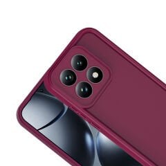 Xiaomi 15T Uyumlu Kılıf Kamera Korumalı Ananas Kapak